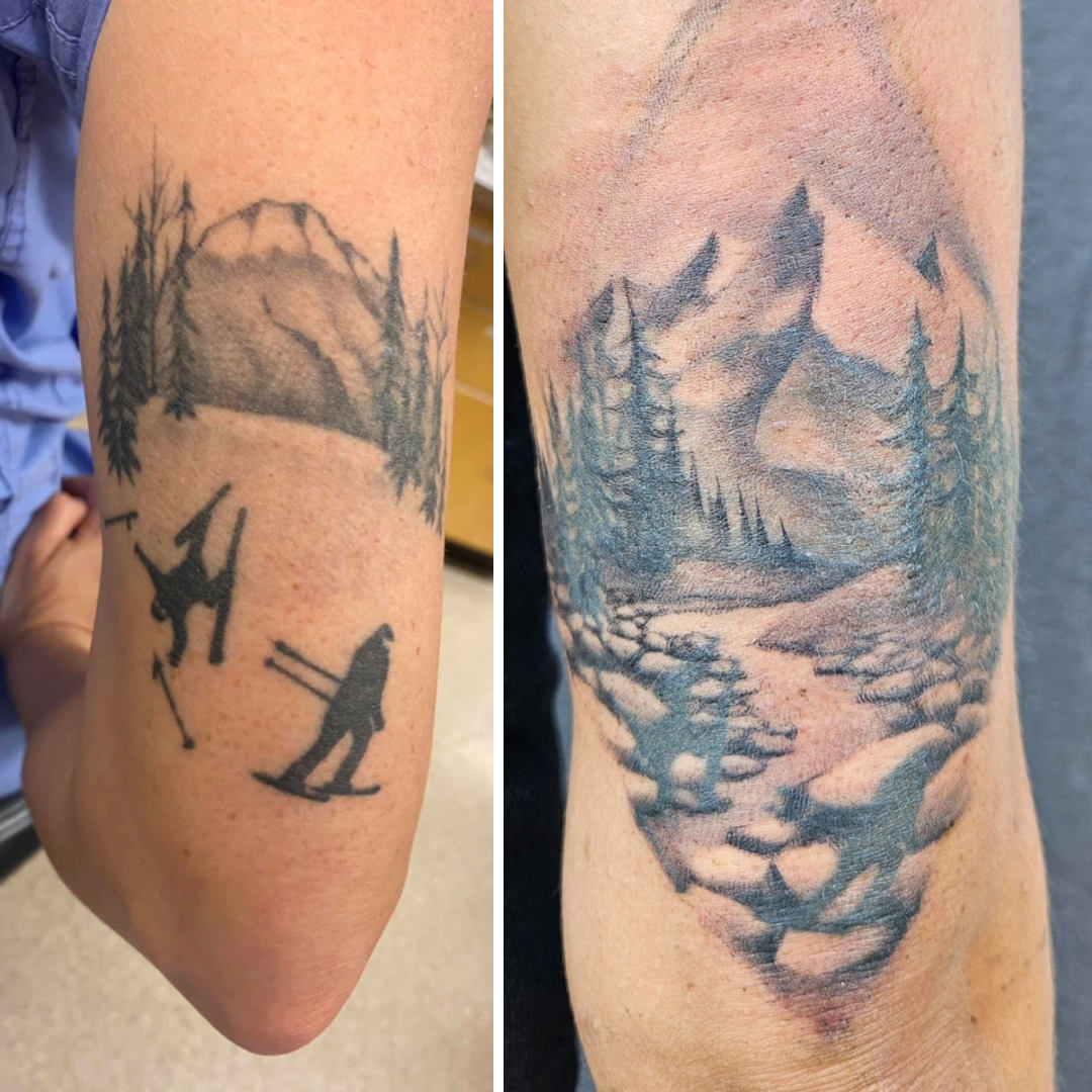 Greyshade Tricep Coverup — Clay Walker Tattoo